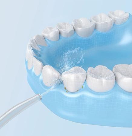 Ирригатор Xiaomi Mijia Electric Flusher (MEO701) Белый